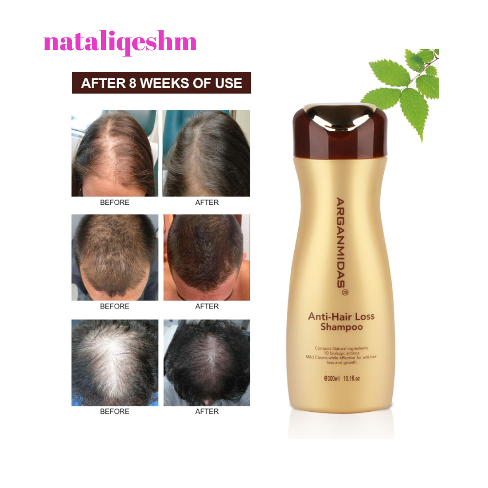 شامپو ضد ریزش آرگان میداس Anti Hair Loss Shampoo